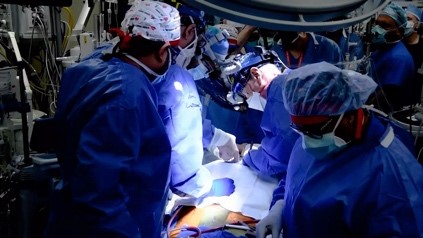  Heboh, Transplantasi Jantung Babi ke Tubuh Manusia Sukses Selamatkan Pasien yang Sekarat  (Sumber foto : Prambors FM)