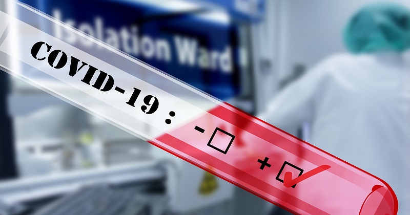 移工需在入境時及檢疫結束前做PCR檢測。 圖／翻攝自Pixabay圖庫