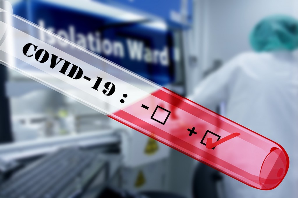 ตั้งแต่วันที่ 4 ม.ค.รายงานผลตรวจเชื้อโควิด-19 ด้วยวิธี PCR ก่อนขึ้นเครื่อง โดยเปลี่ยนเป็นผลตรวจ “ภายใน 2 วัน” ภาพจาก／คลังภาพ Pixabay