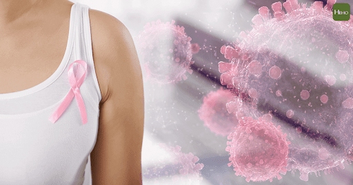 Insiden kanker payudara di kalangan orang modern semakin meningkat. Ilustrasi oleh Heho Health.