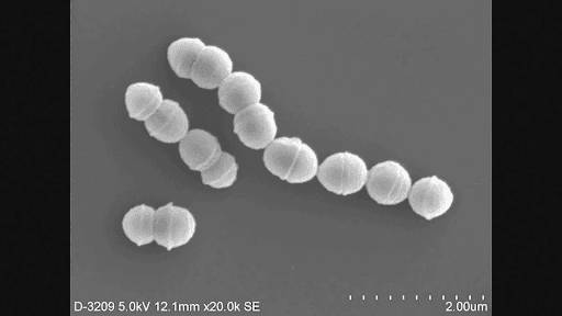 Vi khuẩn nhóm A Streptococcus là một loại nhiễm trùng vi khuẩn phổ biến. (Hình ảnh / Ảnh minh họa)