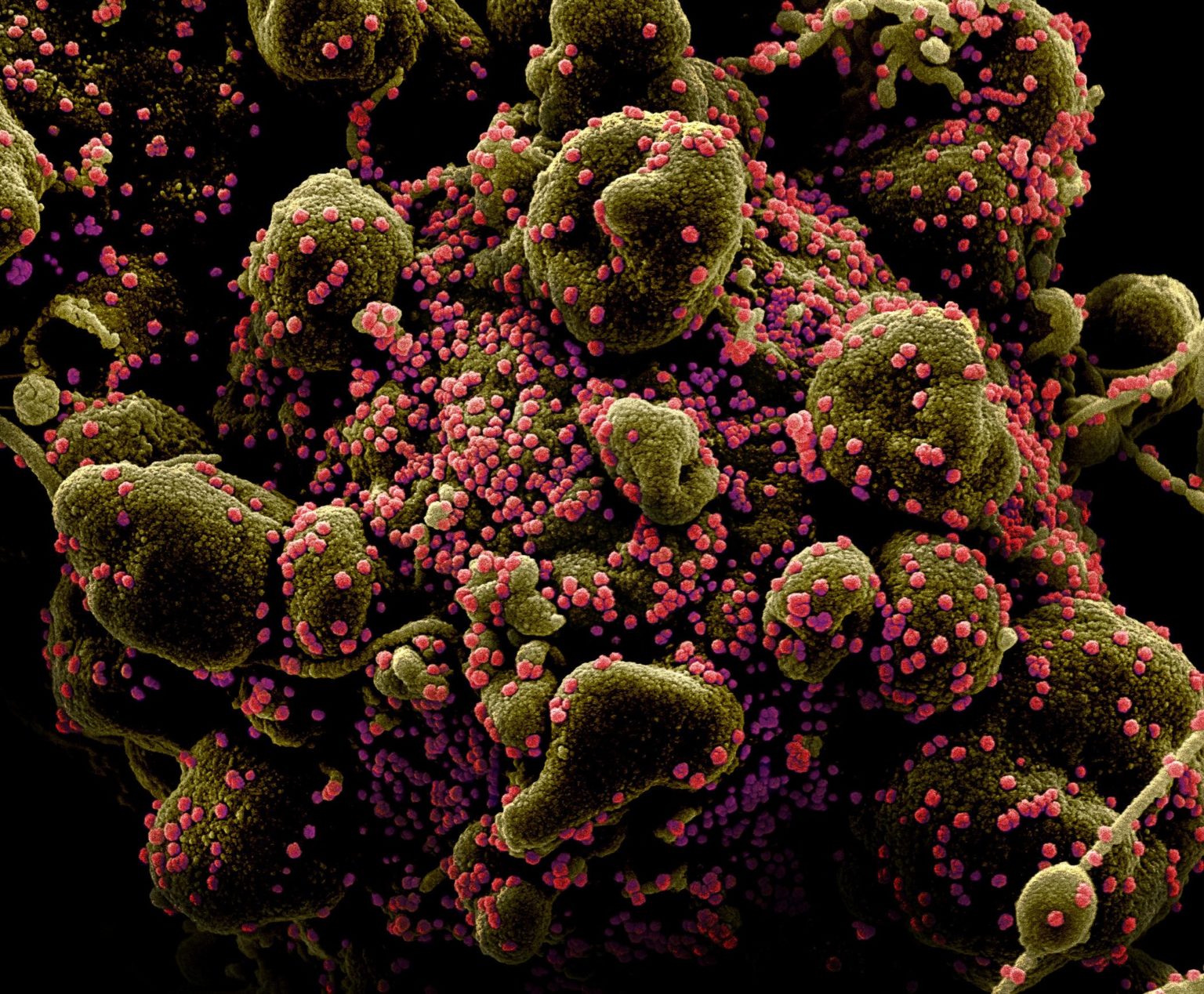 FILE PHOTO: Colorized scanning electron micrograph of an apoptotic cell (greenish brown) heavily infected with SARS-COV-2 virus particles (pink), also known as novel coronavirus, isolated from a patient sample. Image captured and color-enhanced at the NIAID Integrated Research Facility (IRF) in Fort Detrick, Maryland. National Institute of Allergy and Infectious Diseases, NIH/Handout via REUTERS.
