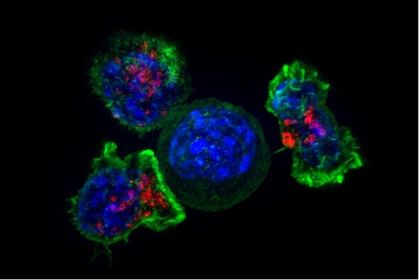 Research team finds drug allergies related to antigen-specific T-cell receptors