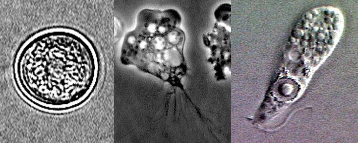 While playing in the water, a woman in New Taipei contracted the "brain-eating amoeba" and passed away.  Photo reproduced from Wikipedia 